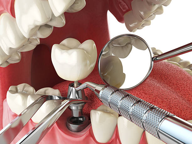 Best Emergency Treatment for Jaw Pain or Injury in Steiner Ranch, TX